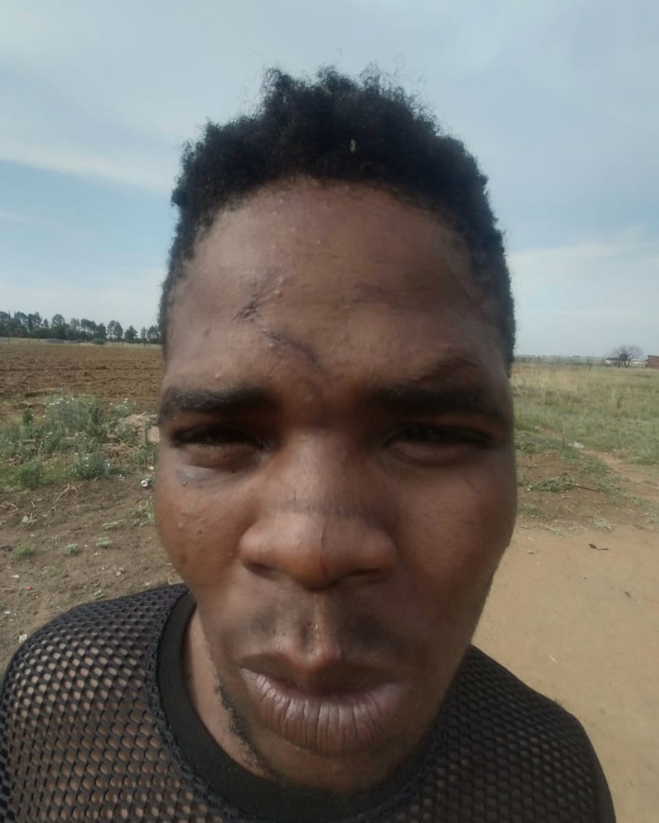 Sifiso Dlomo was allegedly beaten up with a chain by a Midvaal Municipality MMC.