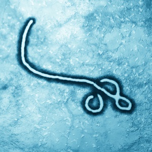Marburg virus strains are very similar to the Ebola virus. 