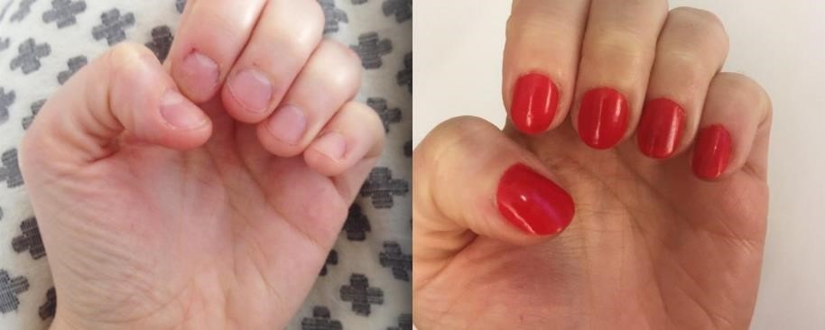 How anti-biting polishes can help you break nervous habits instead of your  nails | Life