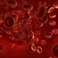 Time to rethink ideas about exercise, sickle cell disease?
