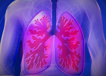 Upper body-COPD-Kalhh-Pixabay