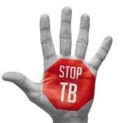 Gauteng health fails TB test: No facilities meet requirements to curb disease's spread