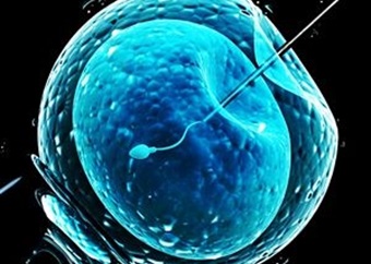 Standard IVF is fine for most. So why are so many offered an expensive sperm injection they don’t need?