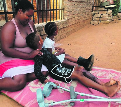 Worried mum Lydia Ngozo with her son, who was injured at school.Photo by Kgalalelo Tlhoaele
